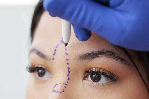 Plastische Chirurgie